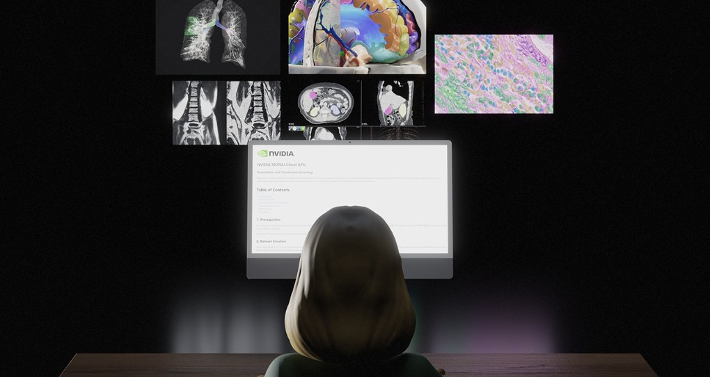 NVIDIA cung cấp MONAI dưới dạng dịch vụ đám mây: Hỗ trợ mạnh mẽ cho Medical Imaging
